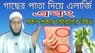 গাছের পাতা দিয়ে এলার্জি ও সকল প্রকার চর্মরোগের ঔষধ।#kobiraj #bari #mk