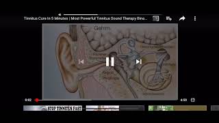 Tinnitus sound therapy