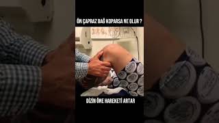 DİZ ÖN ÇAPRAZ BAĞ KOPMASI NASIL ANLAŞILIR ?