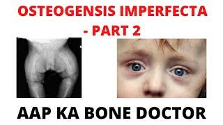 OSTEOGENESIS IMPERFECTA  - PART 2 - EPISODE 52