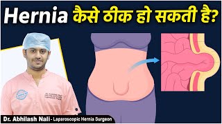 हर्निया का इलाज || How to Treat Hernia Permanently? || Hernia Treatment in Hindi || Dr Abhilash Nali