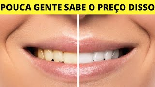 QUANTO CUSTA PARA COLOCAR LENTES NOS DENTES? 🤑