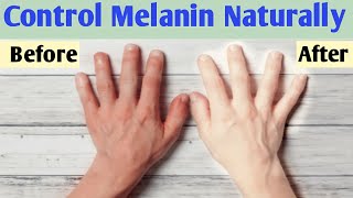 How to reduce melanin in skin naturally | Melanin kam karne ke upay