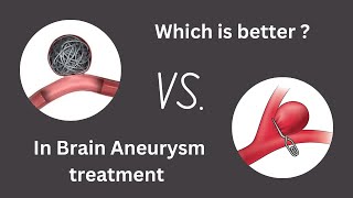 Catheter or Surgery ? In Brain Aneurysm treatment