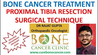 LIMB SALVAGE SURGERY BONE CANCER OSTEOSARCOMA PROXIMAL TIBIA RESECTION-SURGICAL TECHNIQUE