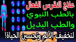 علاج النقرس الفعال بالأعشاب بالطب النبوي والطب البديل لتخفيف الألم وتحسين الحياة!