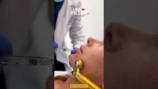 Get Perfect Lips with Filler Injections by Dr. Farshad | EDEN AESTHETICS Clinic Dubai