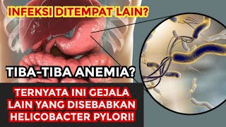 GEJALA LAIN DARI HELICOBACTER PYLORI SELAIN GANGGUAN PENCERNAAN