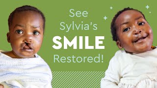 See Sylvia's Smile Restored!