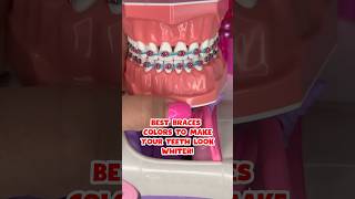 Best BRACES COLORS that make your TEETH LOOK WHITER 🦷 #braces #bracescolors #shorts