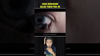 LEBAH BERSARANG DALAM TUBUH PRIA INI