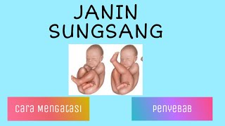 Posisi Janin Terbalik-Letak Janin SUNGSANG-Jangan Panik & Khawatir !