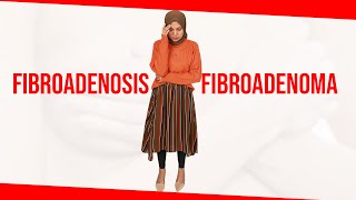 Fibroadenosis vs Fibroadenoma