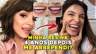 4 ANOS DEPOIS - ME ARREPENDI? ESCURECEU? A VERDADE de como estão meus dentes!