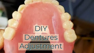 DIY Denture Repair: Easy Step-by-Step Home Solution”