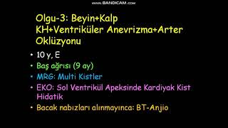 Köpek Kisti, Kist Hidatik, Ülkemizde Nadir Kist Hidatik Olguları, Literatür