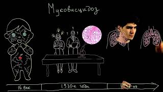 Муковисцидоз: видео-расследование. Cystic fibrosis