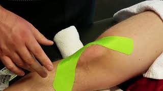 Knee Stability K taping