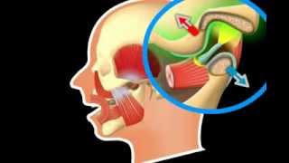 What is TMJ?