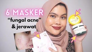 6 Masker (Face Mask) Aman Fungal Acne + Jerawat