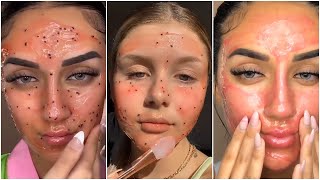 [ Tiktok ] Skincare Routine - Best Skincare Routine Tiktok