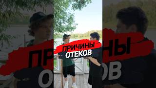 🔥ПРИЧИНЫ ОТЕКОВ