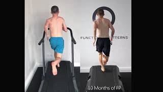 ACL Rehab Gait Before/After. Luke Back View.