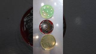 Pseudomonas aeruginosa growth on blood agar and macConkey agar and moeller hinton agar #bacteria