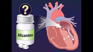 Aficamten for Obstructive Hypertrophic Cardiomyopathy | NEJM