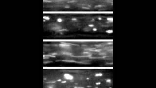 Axonal Organelle Transport in Motion