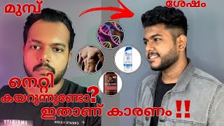 Reasons why men loose hair | How to stop loosing hair | Men's Fashion Malayalam