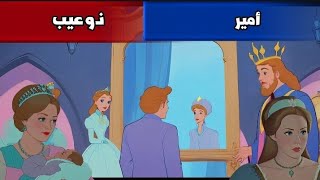 قصة أمير ذو عيب "A Prince with a Flaw"