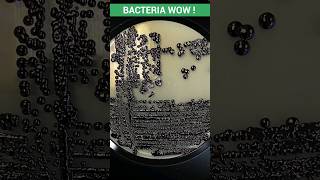 Bacteria Culture WoW😵‍💫 Bacteria culture media | Blood Agar|Chrome Agar| Chocolate Agar #shortvideo