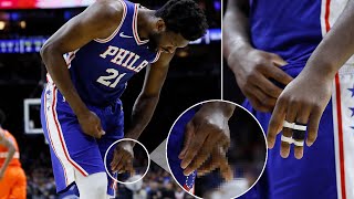 NBA players with Dislocated finger Injury..