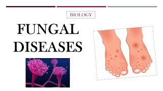 FUNGAL DISEASES | BIOLOGY DETAILS