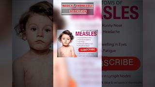 measles symptoms | measles symptoms in babies | #medicalstudents #medicalknowledge