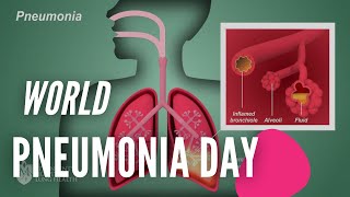 World Pneumonia Day Quotes | World Pneumonia Day Speech | World Pneumonia Day 2020 Theme