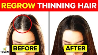 "Natural Methods to Regrow Hair and Banish Bald Spots Forever"