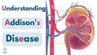 Understanding Addison's Disease Causes, Symptoms, and Management