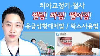 치아교정 철사 빠짐, 찔림, 교정장치 떨어짐, 탈락, 혀 걸림 해결법 / 교정용 왁스 사용법, 교정기 불편감 해결방법 및 응급처치방법입니다.