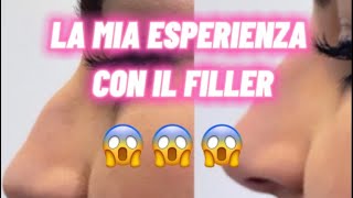 FACCIO IL RINOFILLER AL NASO 😱 E FILLER LABBRA 👄