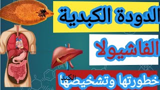 الدودة الكبدية الفاشيولا وخطورتها على الانسان.    Fasciola hepatica