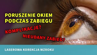 Fakty i mity #11 Poruszenie okiem spowoduje, że zabieg się nie uda.