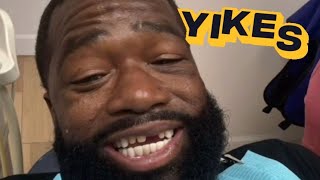 ADRIEN BRONER ARM BROKE?TOOTH KNOCKED OUT? DASS a A$$ WHOOPIN!!!