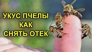 УКУС ПЧЕЛЫ - КАК СНЯТЬ ОПУХОЛЬ, ПЕРВАЯ ПОМОЩЬ, СИМПТОМЫ И ПОСЛЕДСТВИЯ ОТ УКУСА ПЧЕЛЫ