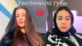 УВЕЛИЧЕНИЕ ГУБ / ПРОШЛО ПОЛГОДА