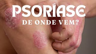 De onde vem a PSORÍASE? Por Dr. Luiz Gameiro, dermatologista