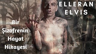 ELLERAN ELVIS  - Bir Şizofrenin Hayat Hikayesi ( 16 Mart Özel ) TÜRKÇE RAP