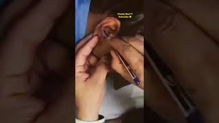 Unintentional asmr ear examination