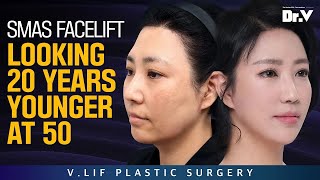 [Korea Plastic Surgery] Revision Mini Facelift at V.LIF Clinic